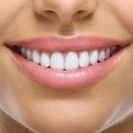 ventajas y desventajas del blanqueamiento dental glam perception en miramar florida